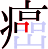 癌の10画目 癌の10画目
