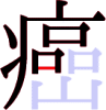 癌の11画目 癌の11画目