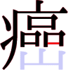 癌の14画目 癌の14画目