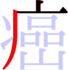 癌の3画目 癌の3画目