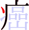 癌の4画目 癌の4画目
