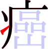 癌の5画目 癌の5画目