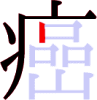 癌の6画目 癌の6画目
