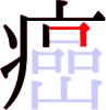 癌の7画目 癌の7画目